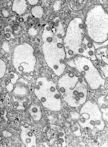 Image: Electron micrograph of Rift Valley fever virus (Photo courtesy of Dr. Fred Murphy, CDC).